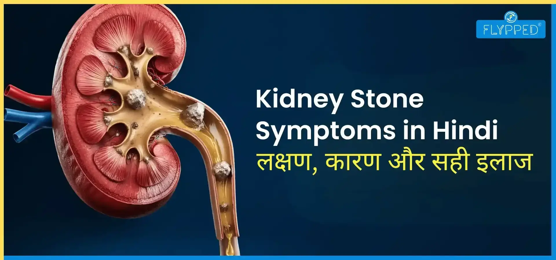  Kidney Stone Symptoms in Hindi: लक्षण, कारण और सही इलाज