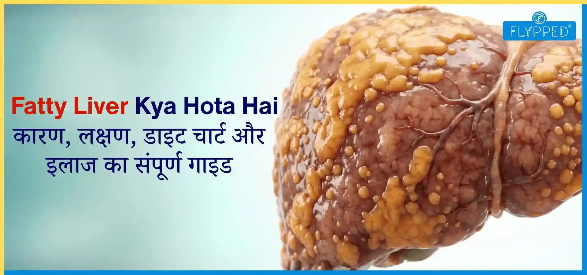 Fatty Liver Kya Hota Hai कारण लक्षण और पूरी जानकारी
